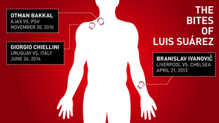 The Gross Things Caused By Human Bite Wounds